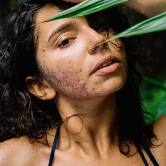 Skin Health Alliance
